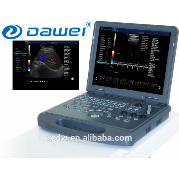 Laptop Farbdoppler Ultraschall Preis &amp; Echographie DW-C60